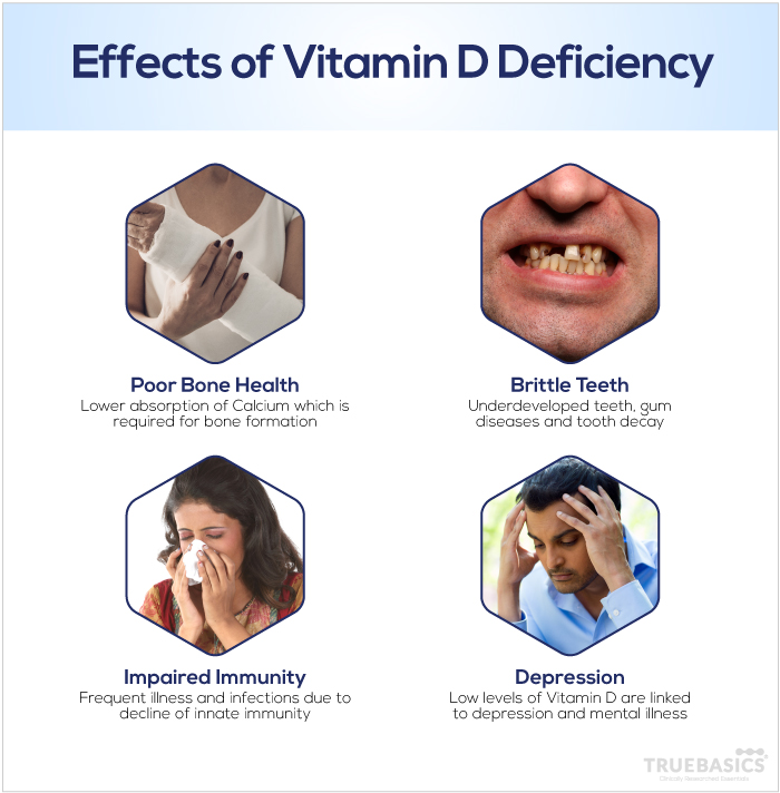 Vitamin D Deficiency: Symptoms, Roles and Sources
