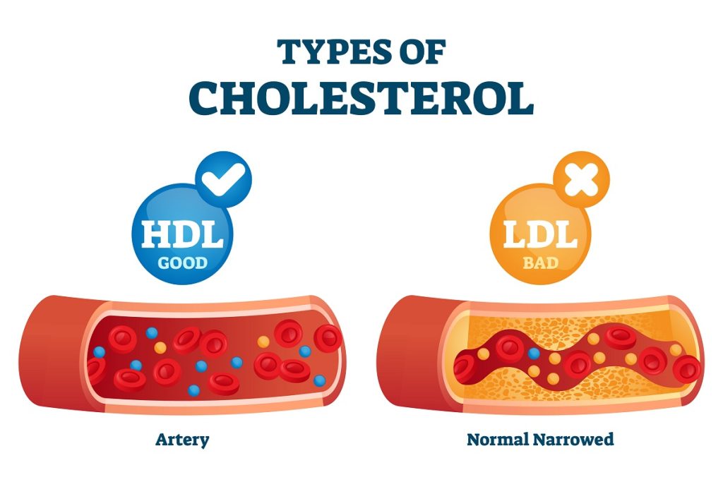 Omega 3 Helps Increase HDL Levels