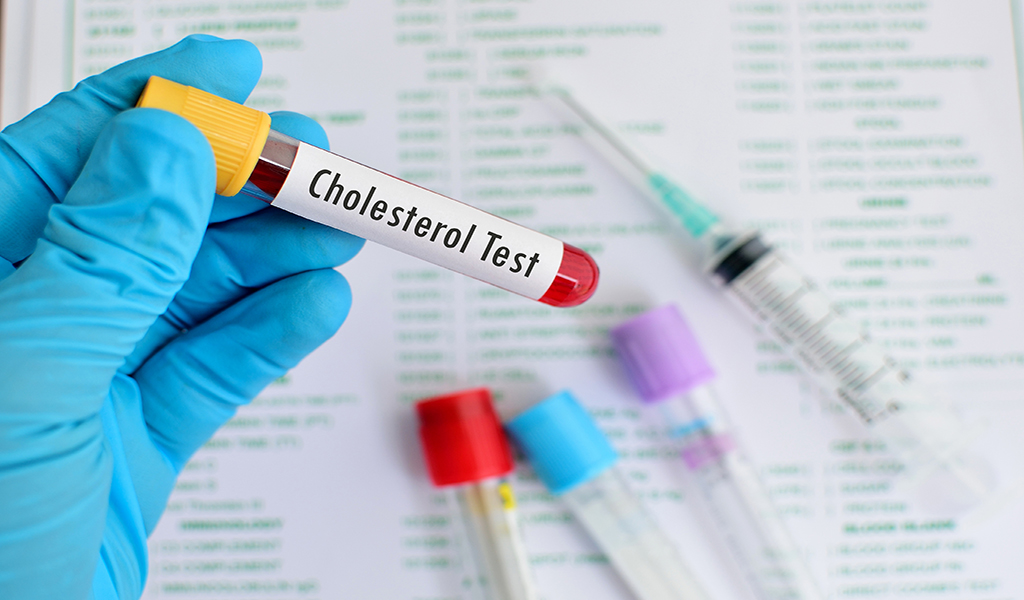 normal levels of HDL and LDL