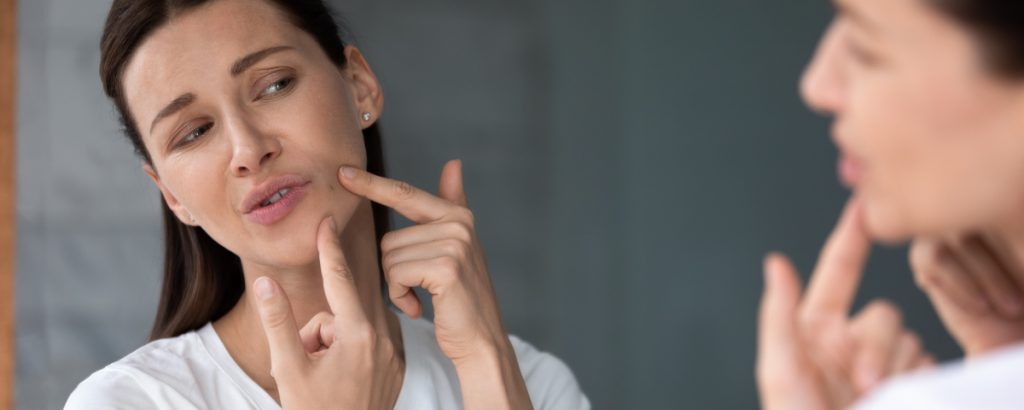 What is Causing Bacne? Understanding Reasons and Remedies